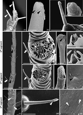 Sensilla Morphology and Complex Expression Pattern of Odorant Binding Proteins in the Vetch Aphid Megoura viciae (Hemiptera: Aphididae)